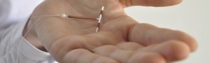 IUD Implants